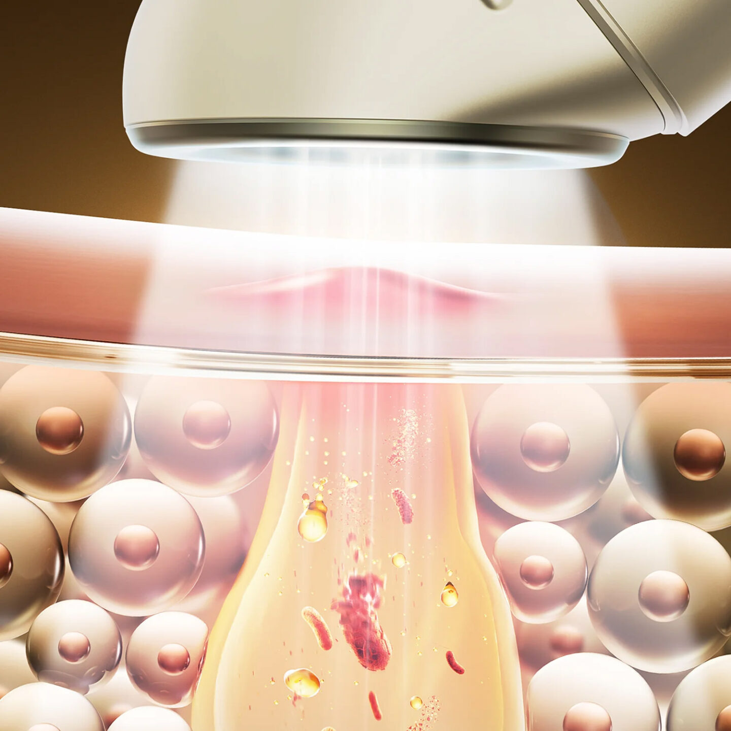 JOVS Acneaway Acne Treatment Device - Image 12