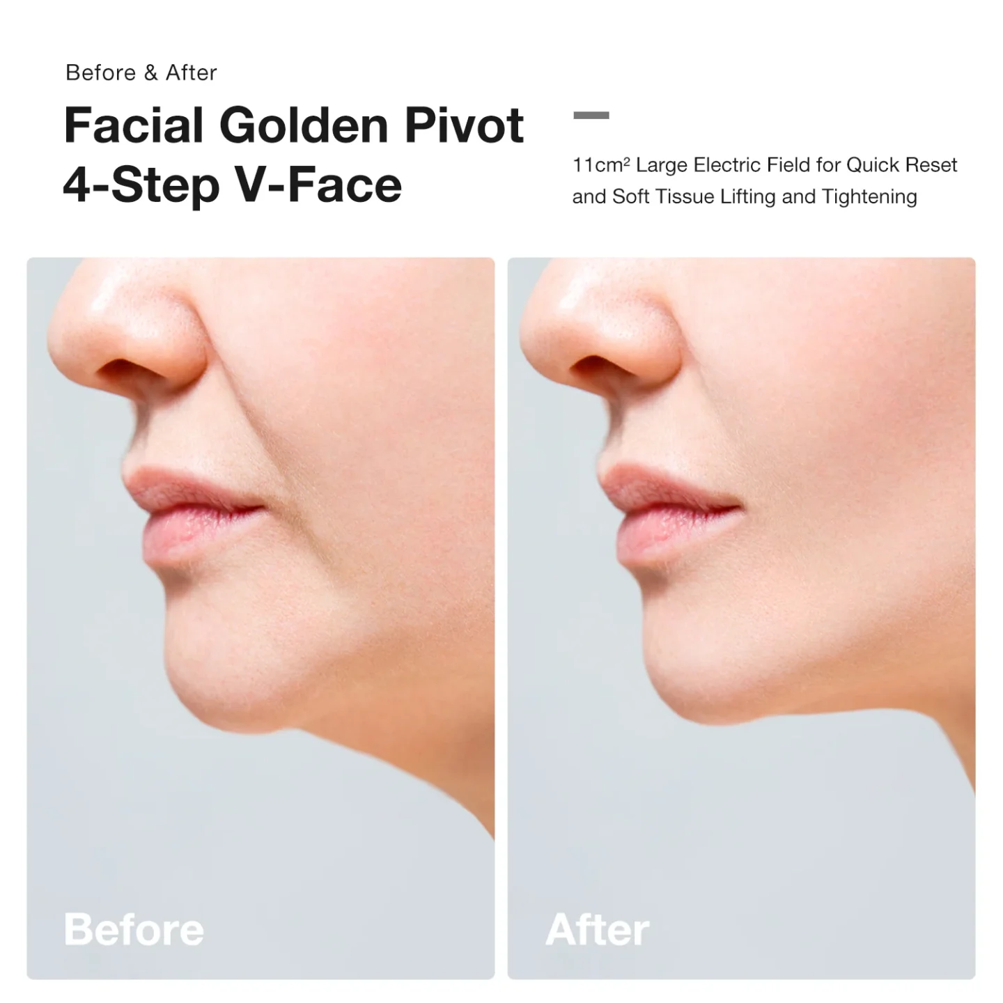 JOVS Slimax Microcurrent Anti-aging Device - Image 11